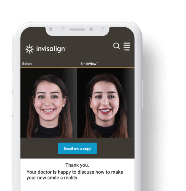 A Invisalign preview of what your smile could look like.