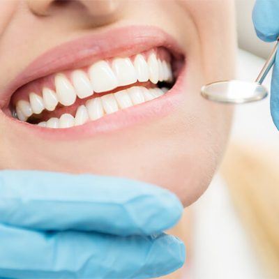 Bright white smile with cosmetic dentistry - dentist in Novi, MI