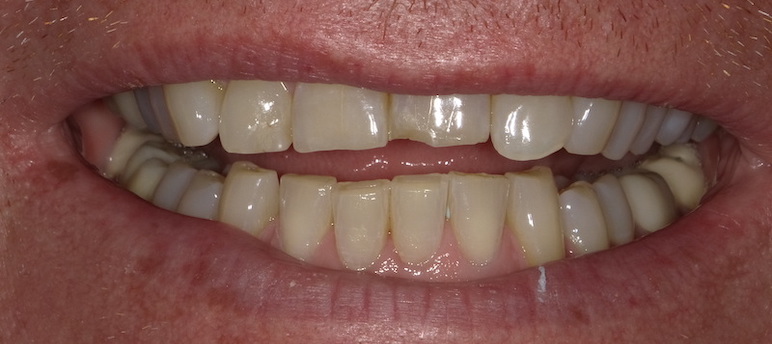 Up close photo of teeth.