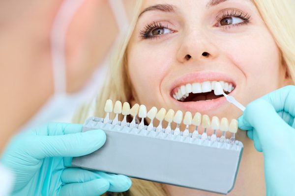 porcelain veneers at Premier Novi Dentistry