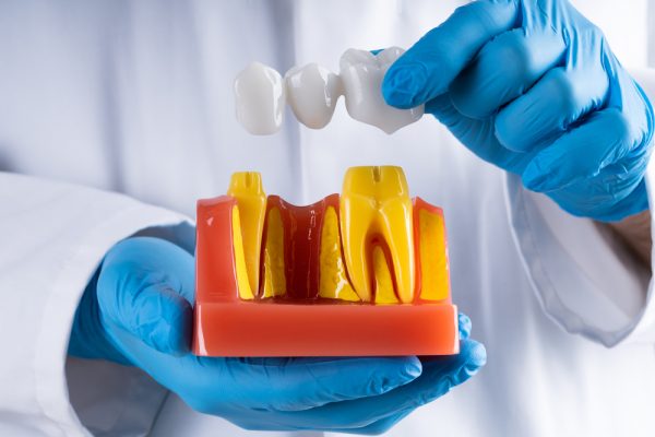 dentist in Novi offering dental bridges