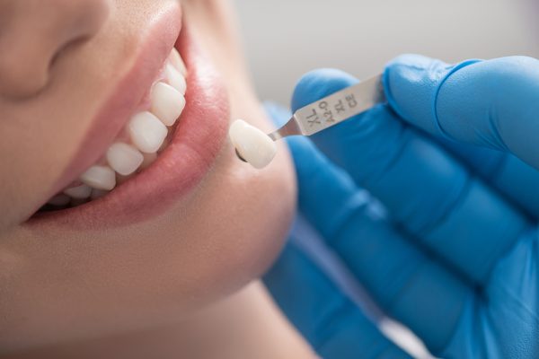 dental crowns at Premier Novi Dentistry