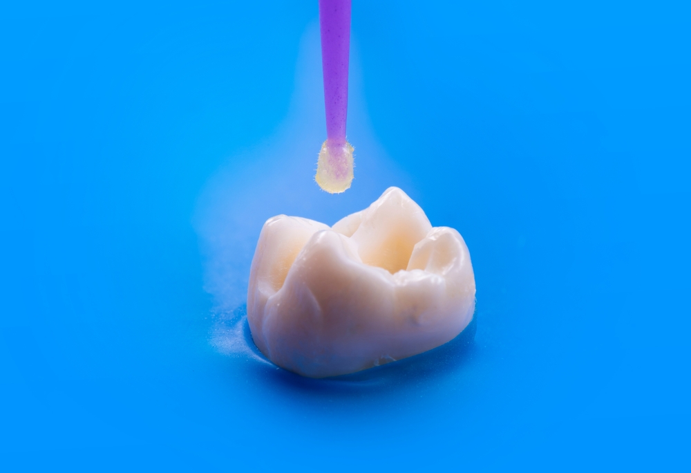 A tooth undergoing dental bonding